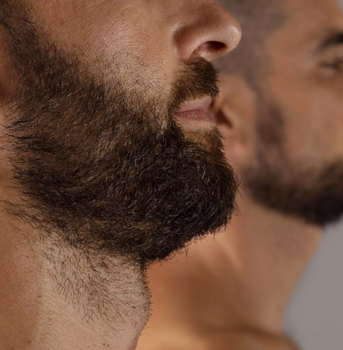 Minoxidil Chapin The King of the Beard Minoxidil Chapin The King of the Beard